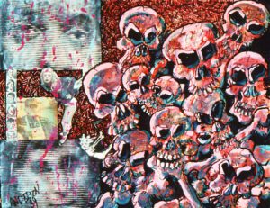 "Brady Skulls" by Stephen P. Anderson